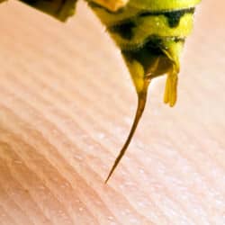 yellow-jacket-stinger